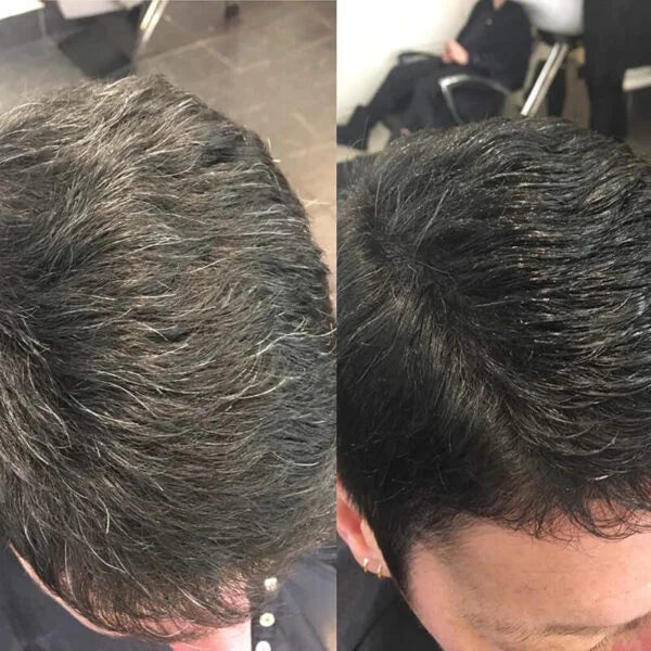 IMPORTED ANTI-GREYING HAIR SERUM