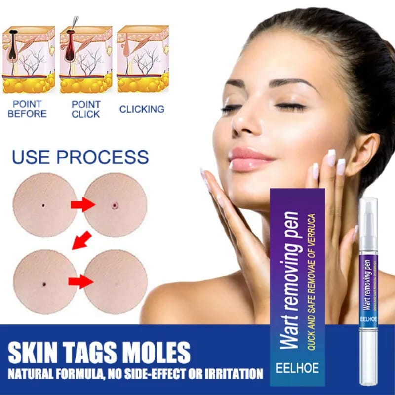 Wipe Off Tags and Mole Remover Pen
